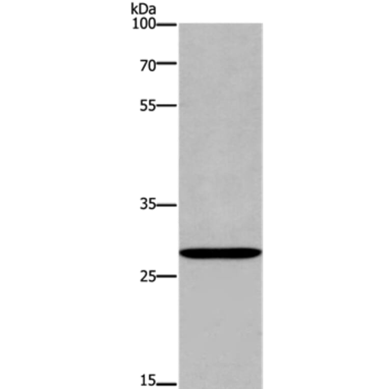 ANP32C Antibody from Signalway Antibody (37145) - Antibodies.com