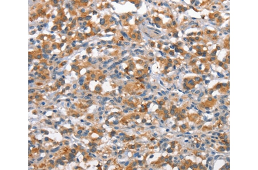 Immunohistochemistry - ANP32C Antibody from Signalway Antibody (37145) - Antibodies.com
