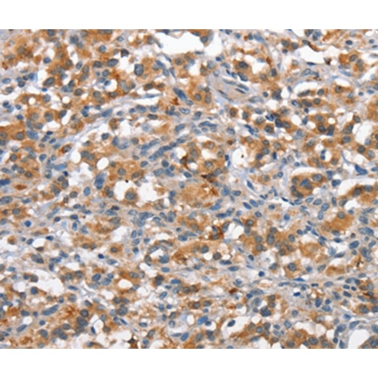 Immunohistochemistry - ANP32C Antibody from Signalway Antibody (37145) - Antibodies.com
