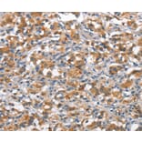 Immunohistochemistry - ANP32C Antibody from Signalway Antibody (37145) - Antibodies.com