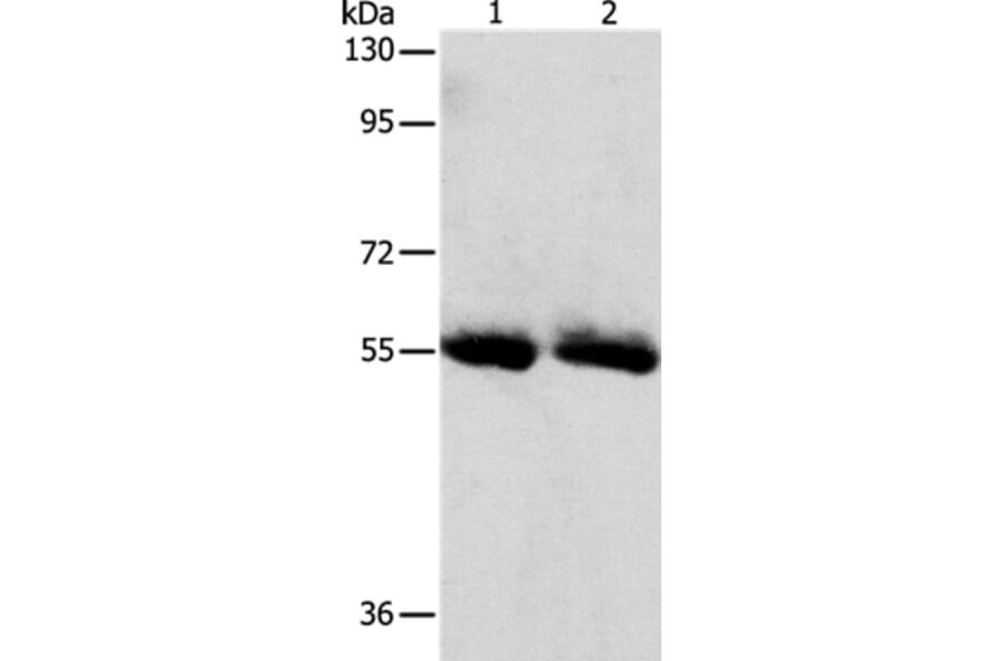 SLC5A5 Antibody from Signalway Antibody (37187) - Antibodies.com