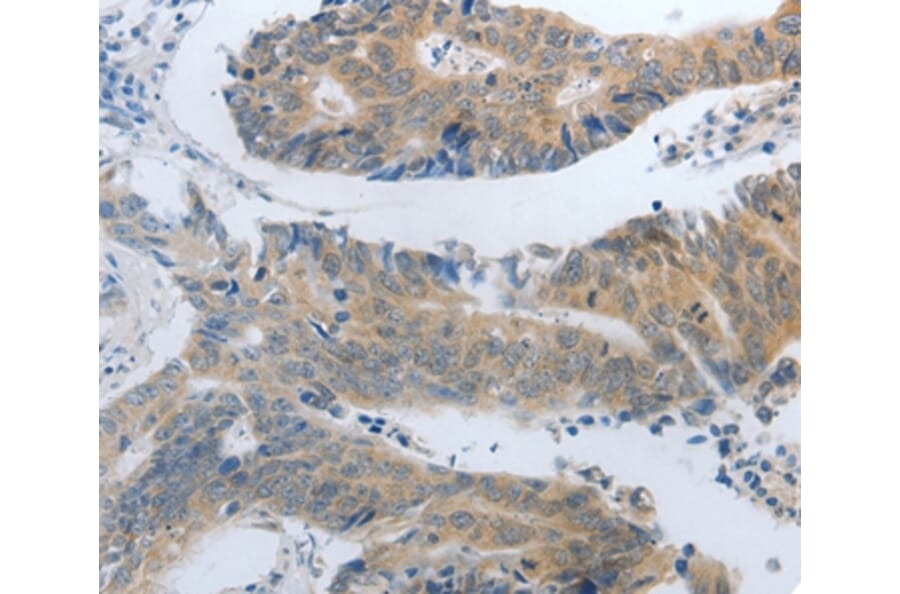 Immunohistochemistry - SLC5A5 Antibody from Signalway Antibody (37187) - Antibodies.com