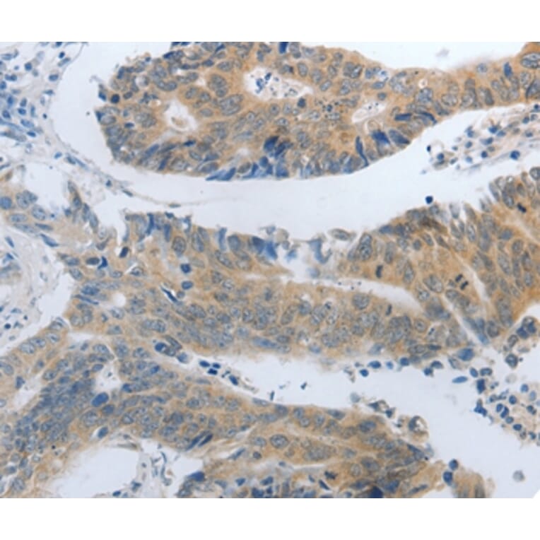 Immunohistochemistry - SLC5A5 Antibody from Signalway Antibody (37187) - Antibodies.com