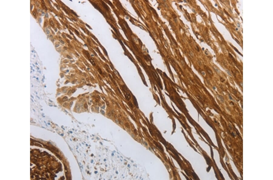 Immunohistochemistry - NOTCH1 Antibody from Signalway Antibody (37192) - Antibodies.com
