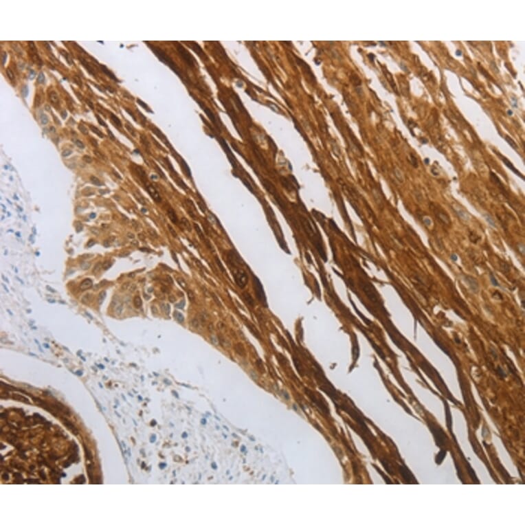 Immunohistochemistry - NOTCH1 Antibody from Signalway Antibody (37192) - Antibodies.com