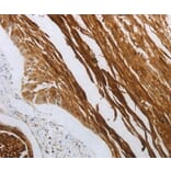 Immunohistochemistry - NOTCH1 Antibody from Signalway Antibody (37192) - Antibodies.com