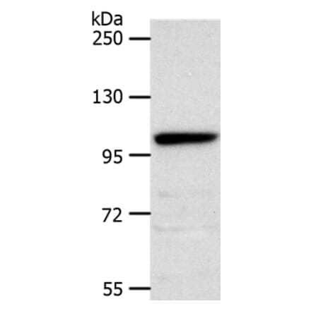 NOTCH2 Antibody from Signalway Antibody (37193) - Antibodies.com