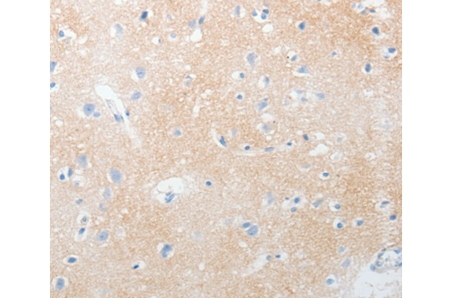 Immunohistochemistry - NOTCH2 Antibody from Signalway Antibody (37193) - Antibodies.com