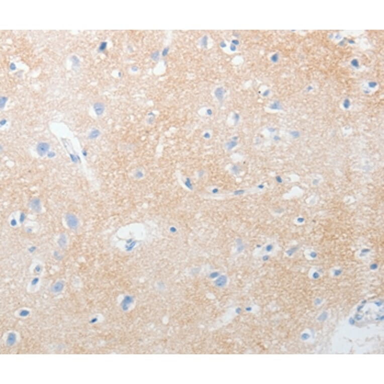 Immunohistochemistry - NOTCH2 Antibody from Signalway Antibody (37193) - Antibodies.com