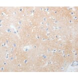 Immunohistochemistry - NOTCH2 Antibody from Signalway Antibody (37193) - Antibodies.com