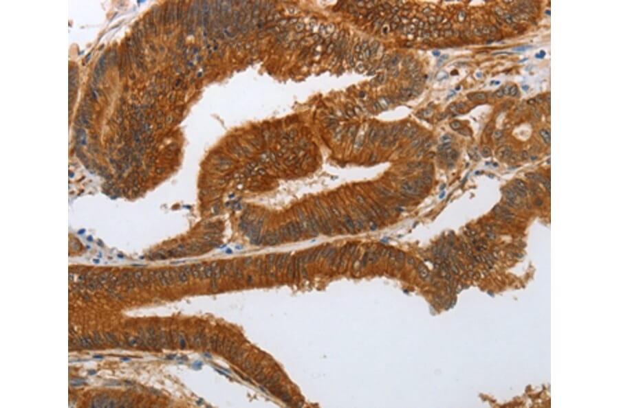 Immunohistochemistry - NOTCH3 Antibody from Signalway Antibody (37194) - Antibodies.com