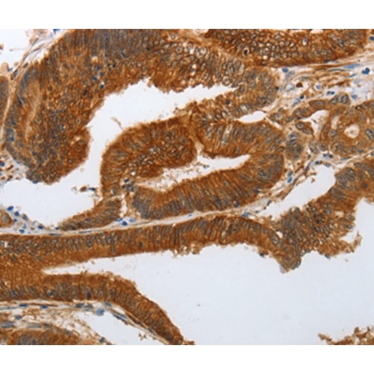 Immunohistochemistry - NOTCH3 Antibody from Signalway Antibody (37194) - Antibodies.com
