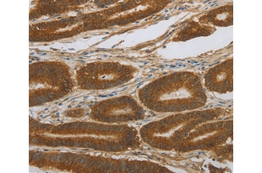 Immunohistochemistry - NOTCH4 Antibody from Signalway Antibody (37195) - Antibodies.com