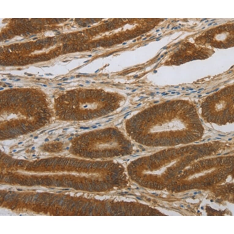 Immunohistochemistry - NOTCH4 Antibody from Signalway Antibody (37195) - Antibodies.com