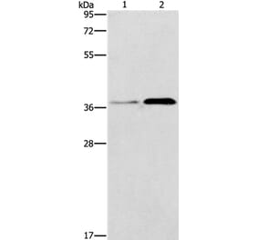 PAFAH2 Antibody from Signalway Antibody (37205) - Antibodies.com