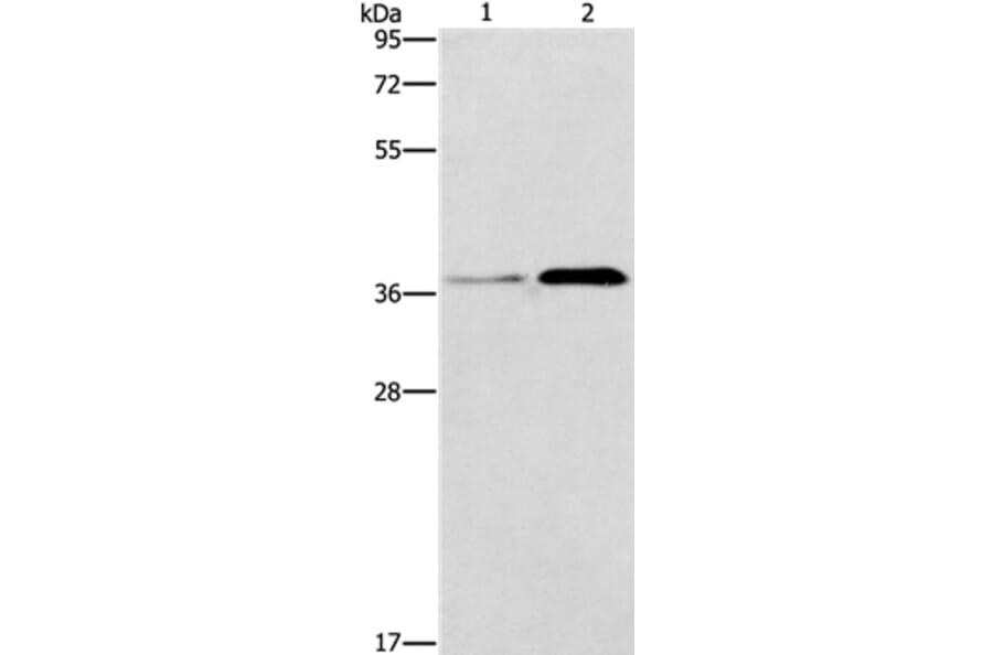 PAFAH2 Antibody from Signalway Antibody (37205) - Antibodies.com