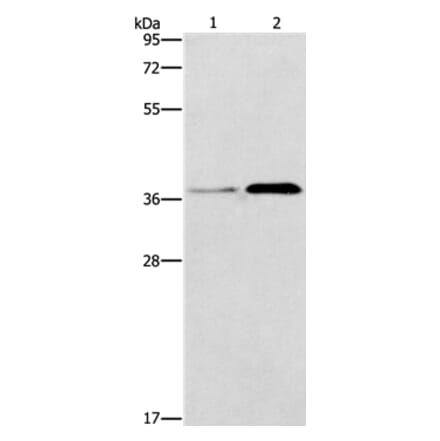 PAFAH2 Antibody from Signalway Antibody (37205) - Antibodies.com