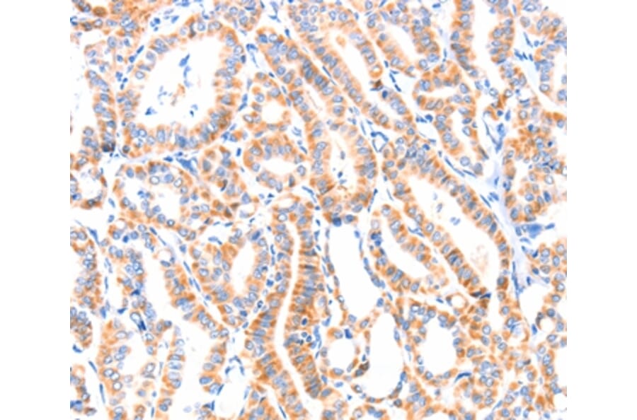 Immunohistochemistry - PAFAH2 Antibody from Signalway Antibody (37205) - Antibodies.com
