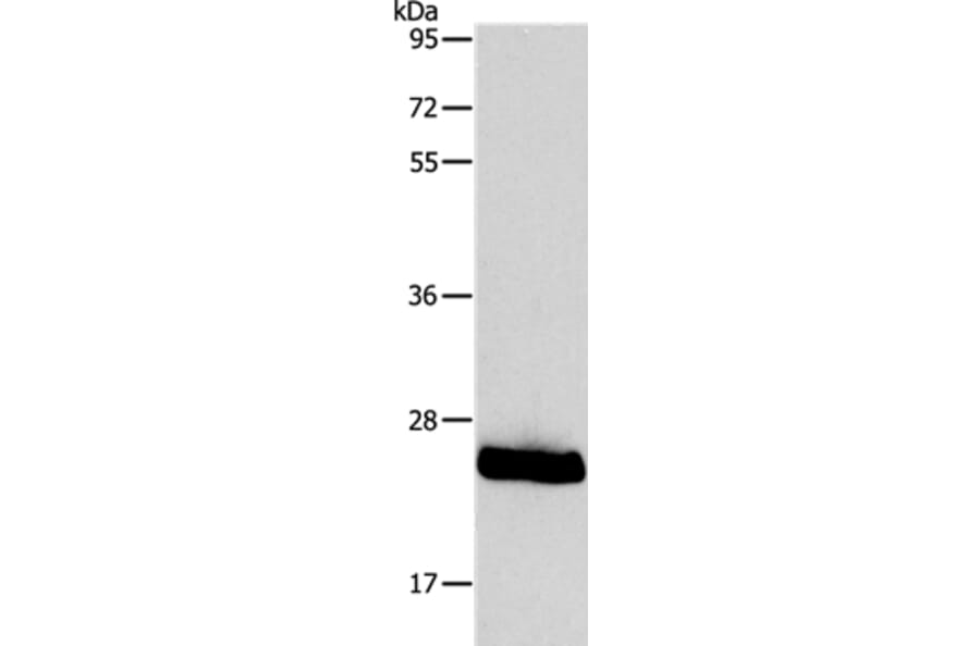 PPAP2C Antibody from Signalway Antibody (37206) - Antibodies.com