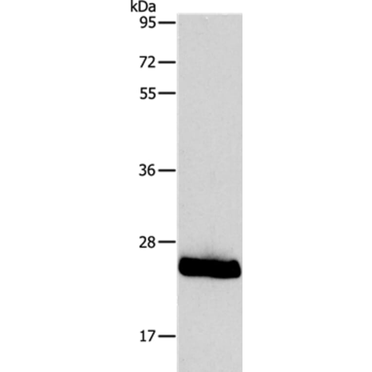 PPAP2C Antibody from Signalway Antibody (37206) - Antibodies.com