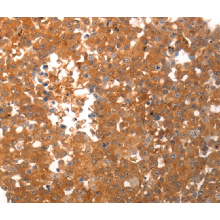 Immunohistochemistry - PPAP2C Antibody from Signalway Antibody (37206) - Antibodies.com