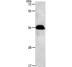 PPP2CB Antibody from Signalway Antibody (37218) - Antibodies.com