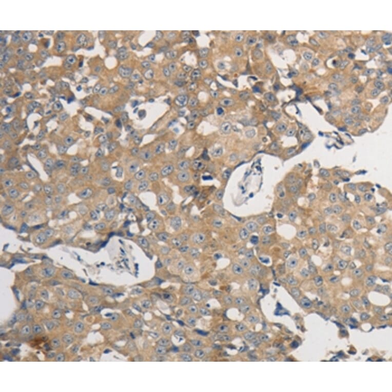 Immunohistochemistry - PPP2CB Antibody from Signalway Antibody (37218) - Antibodies.com