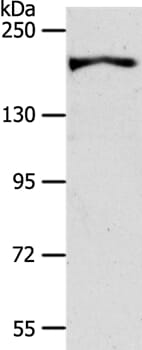 Gel: 8% SDS-PAGE Lysate: 40ug HT-29 cell Primary antibody: 1/600 dilution Secondary antibody dilution: 1/8000 Exposure time: 40 seconds