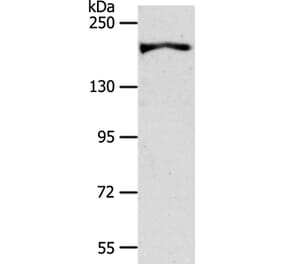 AKAP12 Antibody from Signalway Antibody (37255) - Antibodies.com