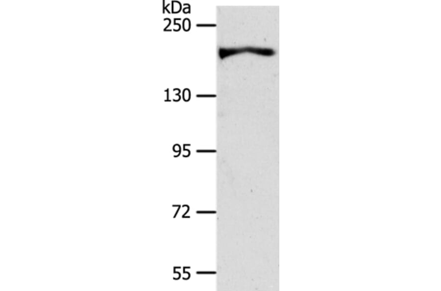 AKAP12 Antibody from Signalway Antibody (37255) - Antibodies.com