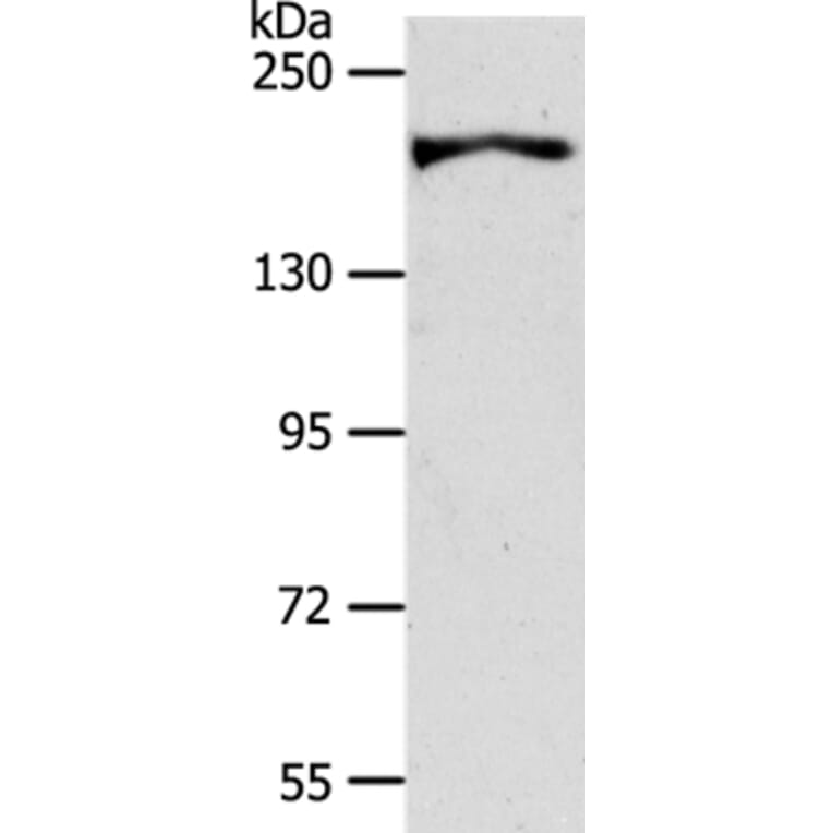 AKAP12 Antibody from Signalway Antibody (37255) - Antibodies.com