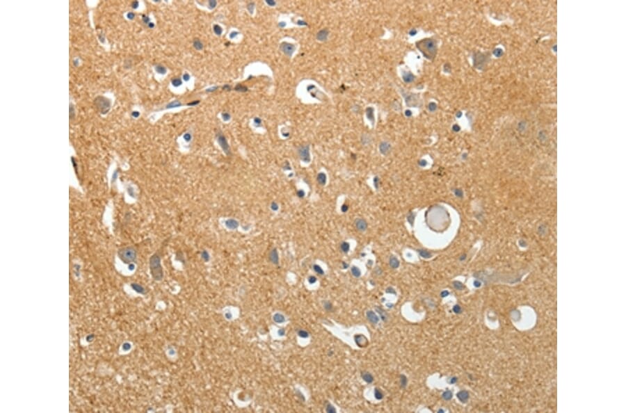Immunohistochemistry - AKAP12 Antibody from Signalway Antibody (37255) - Antibodies.com