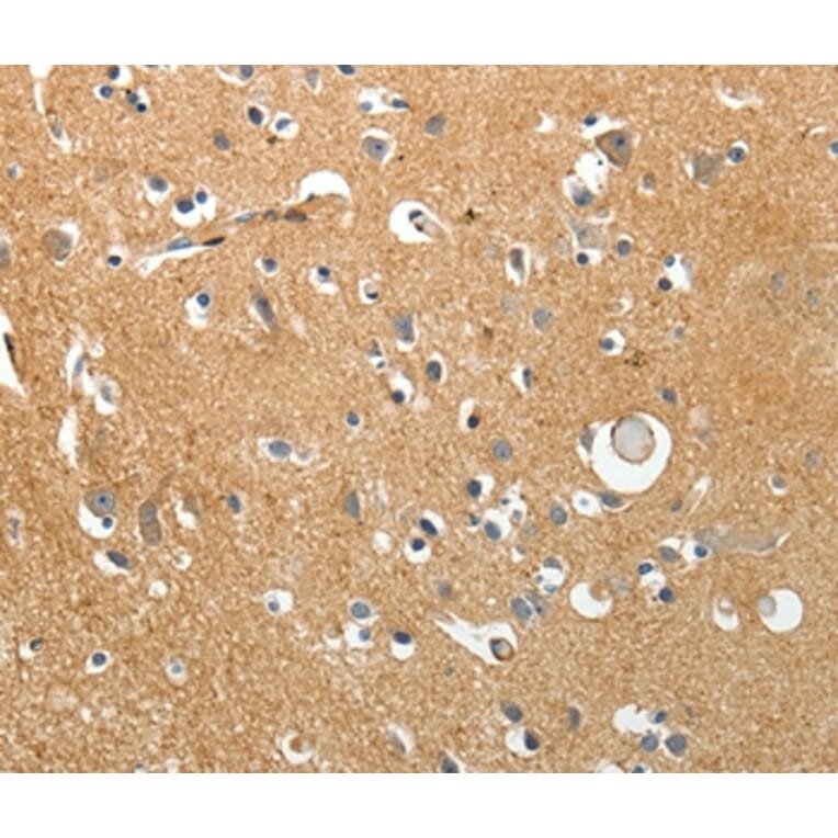 Immunohistochemistry - AKAP12 Antibody from Signalway Antibody (37255) - Antibodies.com