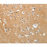 Immunohistochemistry - AKAP12 Antibody from Signalway Antibody (37255) - Antibodies.com