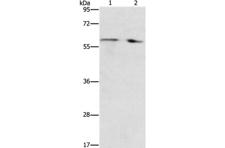 STEAP4 Antibody from Signalway Antibody (37261) - Antibodies.com