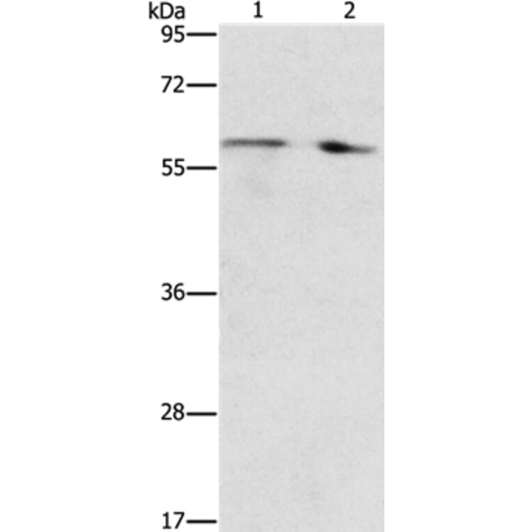 STEAP4 Antibody from Signalway Antibody (37261) - Antibodies.com