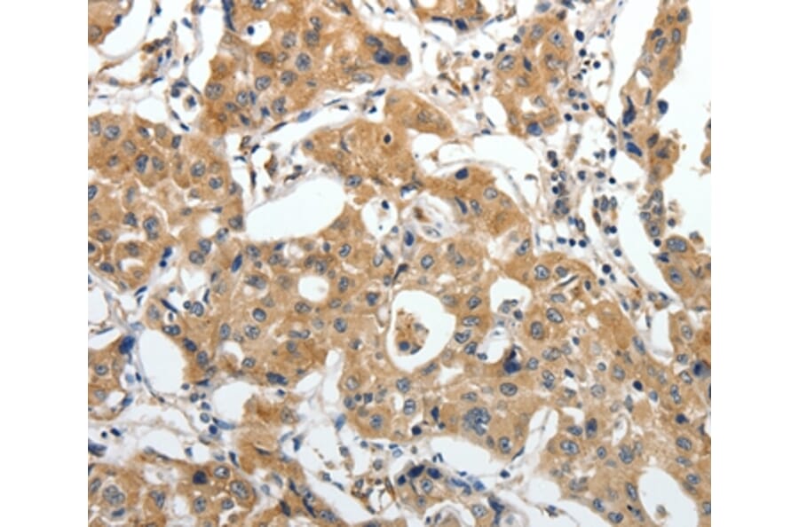 Immunohistochemistry - STEAP4 Antibody from Signalway Antibody (37261) - Antibodies.com
