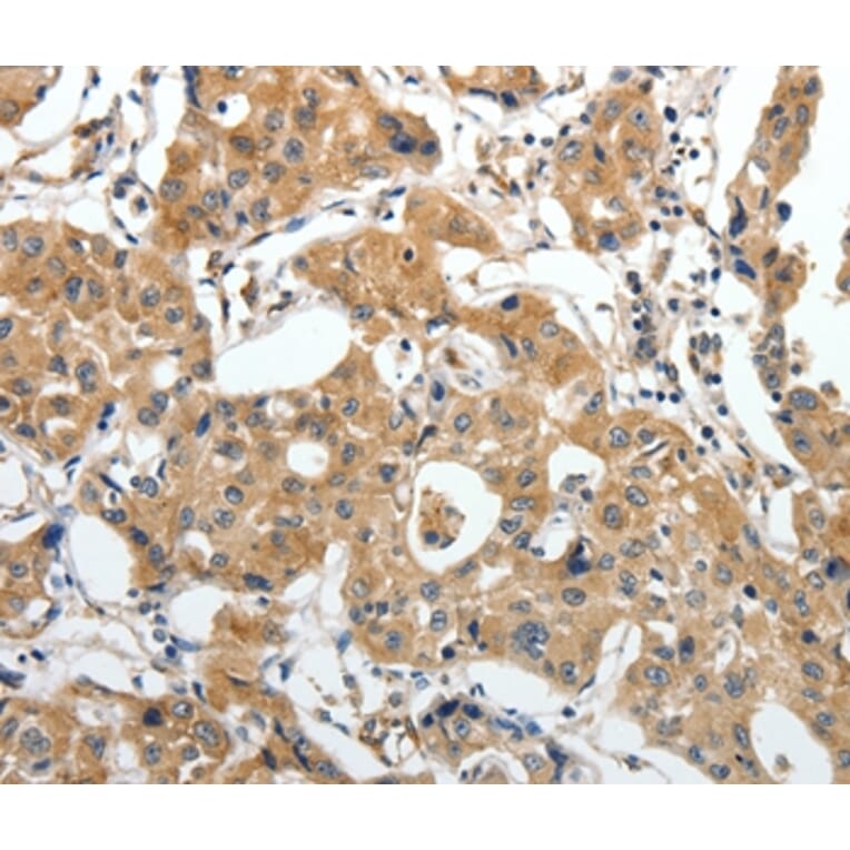 Immunohistochemistry - STEAP4 Antibody from Signalway Antibody (37261) - Antibodies.com