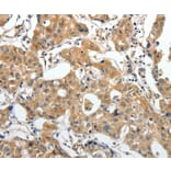 Immunohistochemistry - STEAP4 Antibody from Signalway Antibody (37261) - Antibodies.com