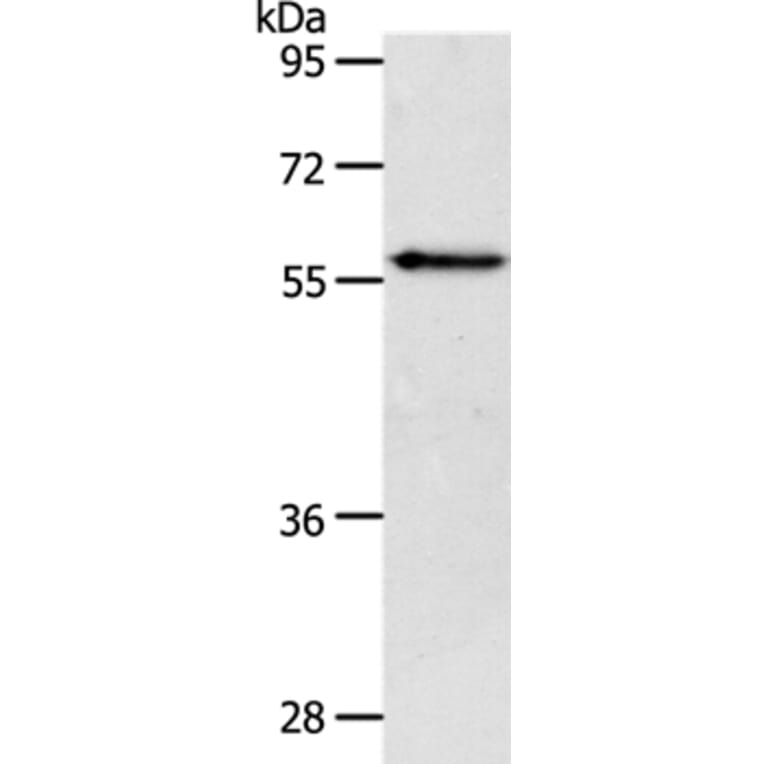 VANGL2 Antibody from Signalway Antibody (37300) - Antibodies.com