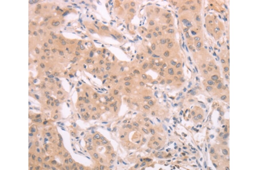 Immunohistochemistry - ADAM11 Antibody from Signalway Antibody (37308) - Antibodies.com