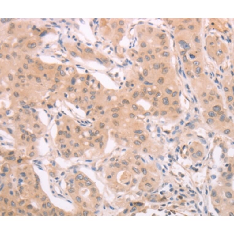 Immunohistochemistry - ADAM11 Antibody from Signalway Antibody (37308) - Antibodies.com