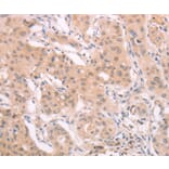 Immunohistochemistry - ADAM11 Antibody from Signalway Antibody (37308) - Antibodies.com
