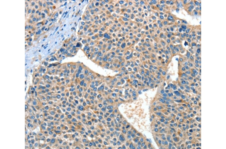 Immunohistochemistry - ADRA1A Antibody from Signalway Antibody (37328) - Antibodies.com