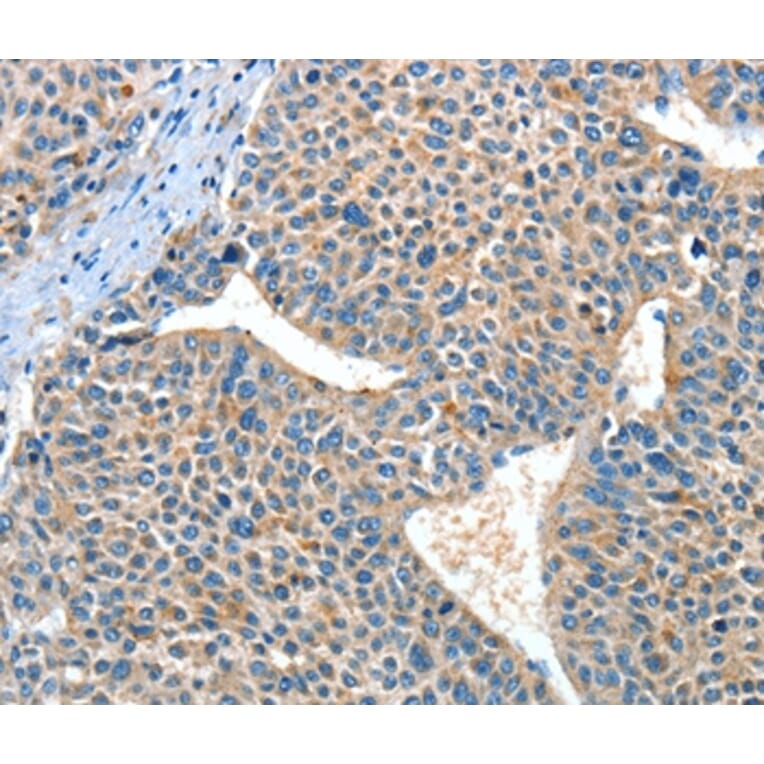 Immunohistochemistry - ADRA1A Antibody from Signalway Antibody (37328) - Antibodies.com