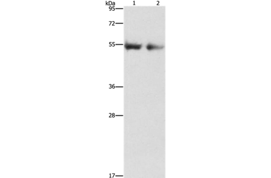 ANGPT4 Antibody from Signalway Antibody (37331) - Antibodies.com
