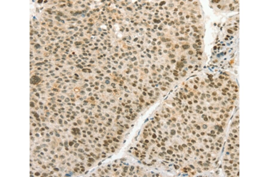 Immunohistochemistry - ANGPT4 Antibody from Signalway Antibody (37331) - Antibodies.com