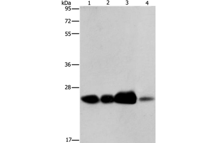ARFRP1 Antibody from Signalway Antibody (37350) - Antibodies.com