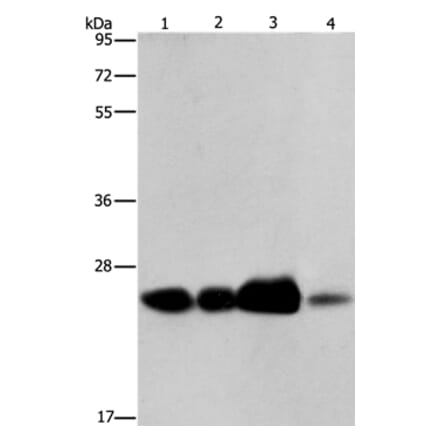 ARFRP1 Antibody from Signalway Antibody (37350) - Antibodies.com