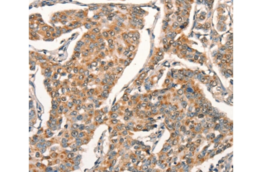 Immunohistochemistry - ARFRP1 Antibody from Signalway Antibody (37350) - Antibodies.com